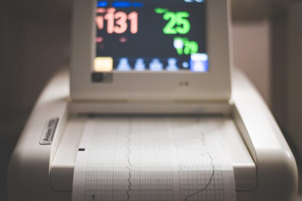 Photo ecg